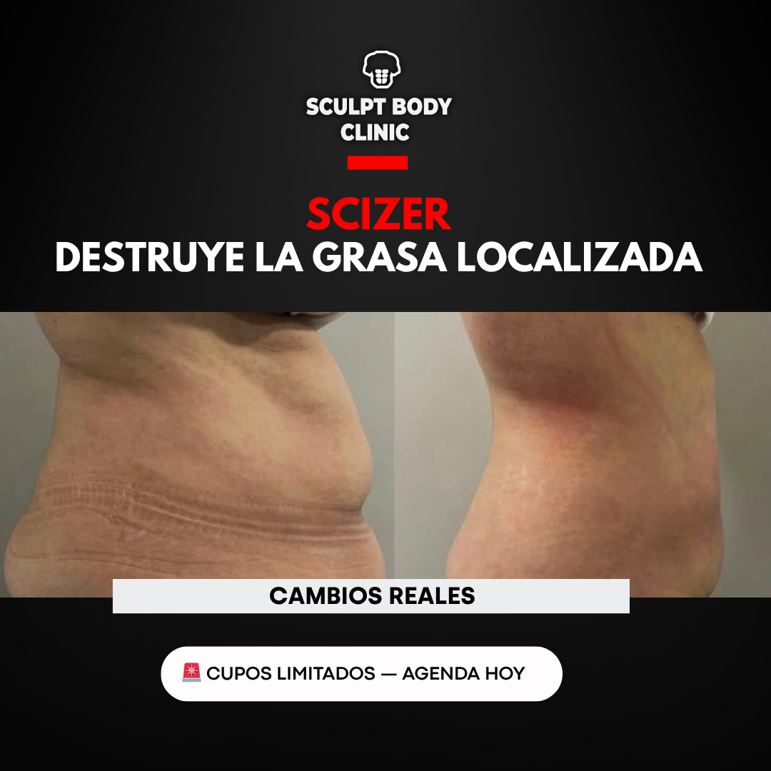 Caso 1