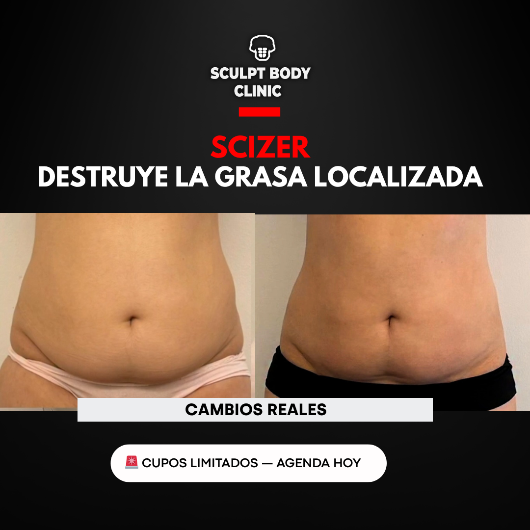 Caso 2