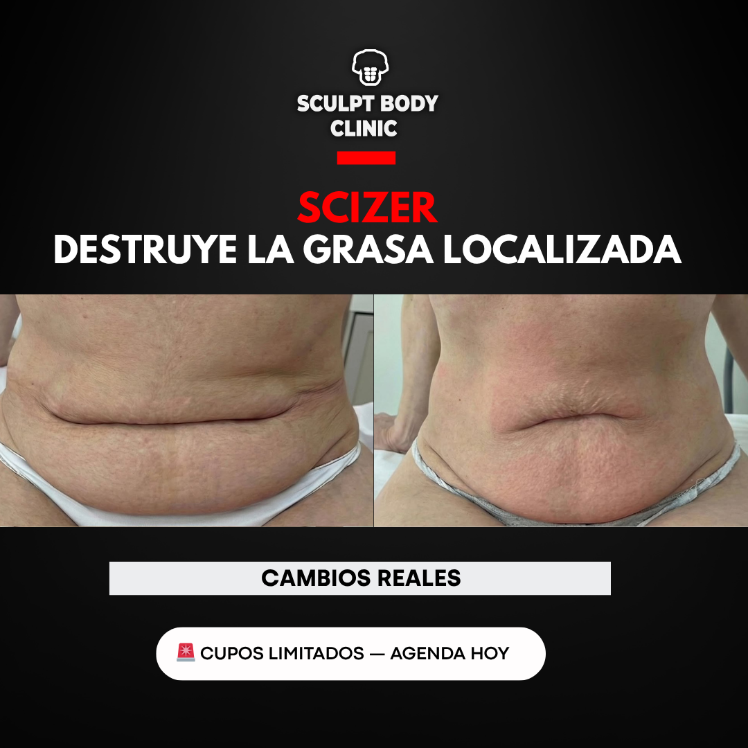 Caso 3